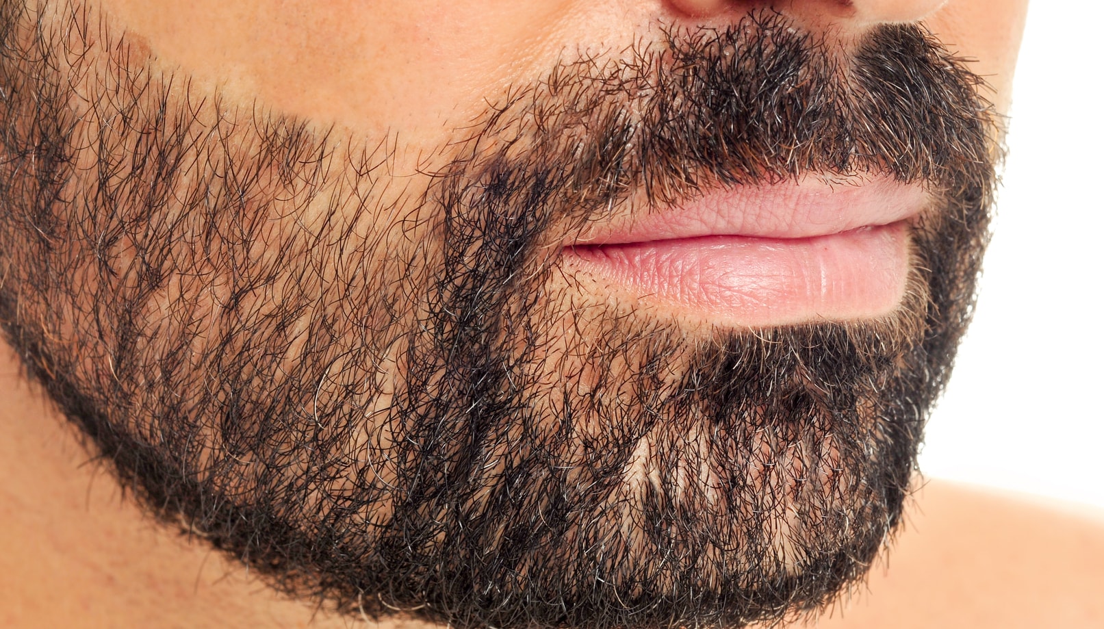 Beard/ Eyebrow/Eyelid Transplant – Fugamed